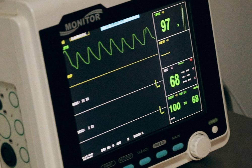 All you ever wanted to know about atrial fibrillation, but were afraid to ask…